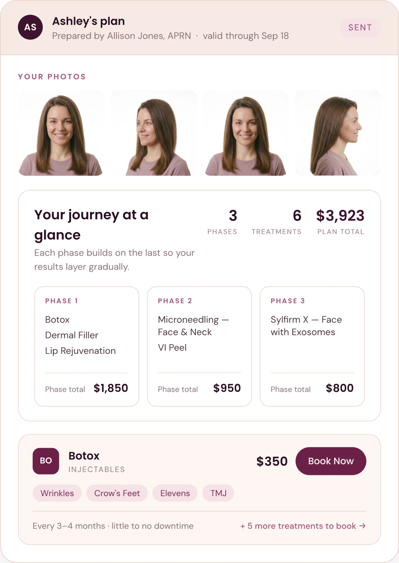 Patient before photos beside Phase 1 of her treatment plan